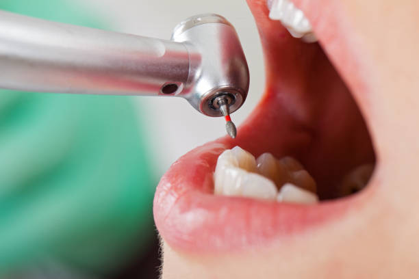 Best Cracked Tooth Emergency Dentist  in Tea, SD